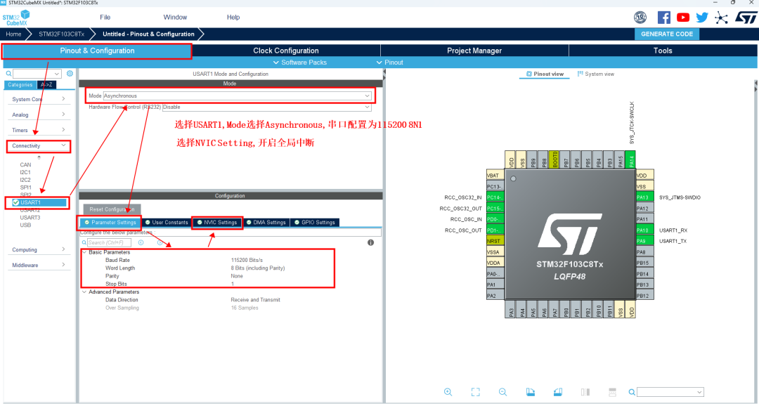 STM32