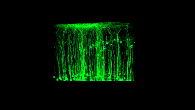 神经纤维的三维结构展示