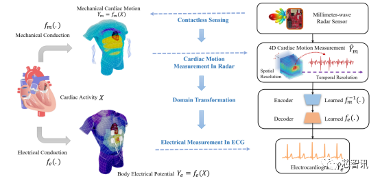 ECG