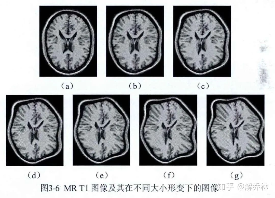 医学成像