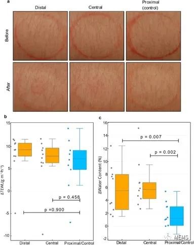 CGM