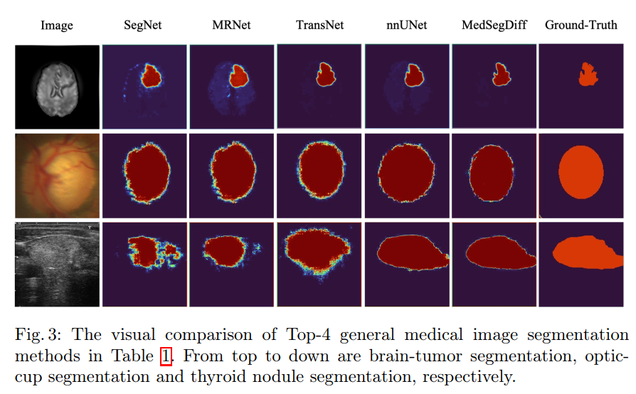 MRI