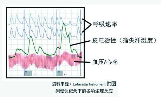 传感器