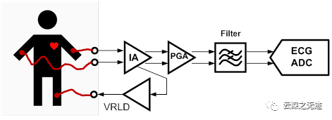 ECG