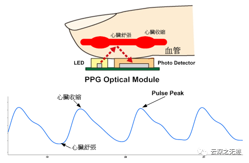 ECG