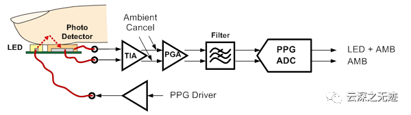 ECG