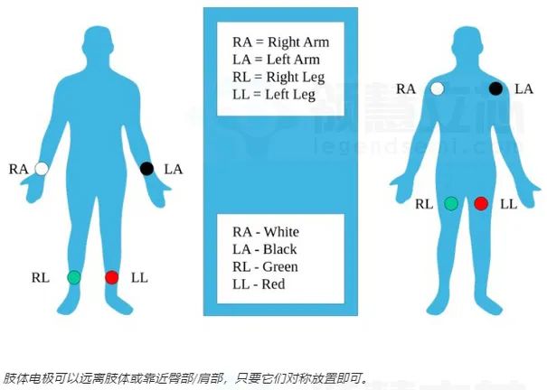 心电图