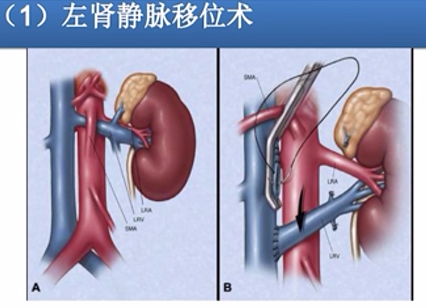 3D打印