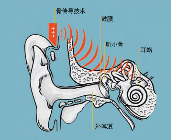 骨傳導耳機比傳統(tǒng)耳機更好嗎，骨傳導耳機發(fā)聲原理科普