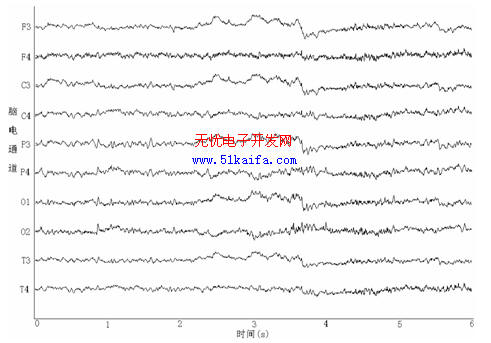 汽車駕駛時腦電干擾的去除方法研究