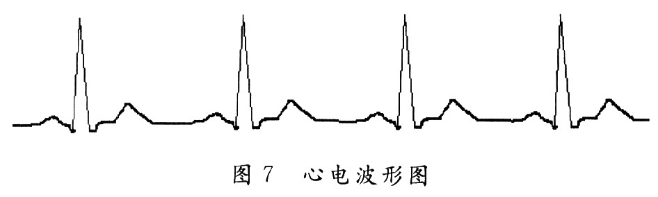 简易心电图仪的设计