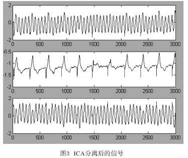 独立分量分析在心电信号处理中的应用
