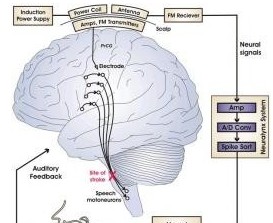 美国研制出大脑思维翻译器欲将思想变语言