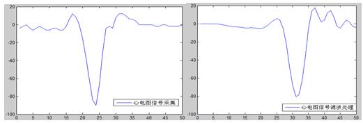 基于MATLAB的实时数据采集与分析研究