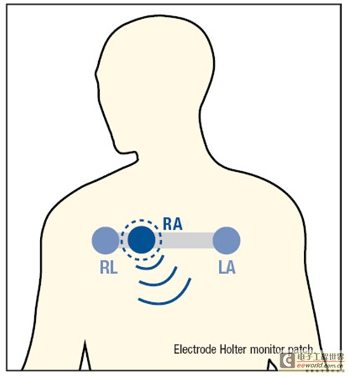 【參考設(shè)計】ADI可穿戴無線ECG動態(tài)心電監(jiān)護(hù)儀