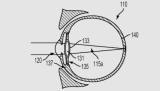 谷歌新专利用电子眼替换晶状体：能矫正近视眼还能拍照