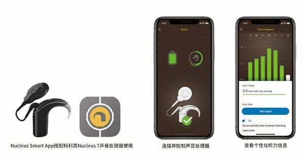 移動互聯(lián)時代專屬人工耳蝸科利耳N7聲音處理器----一機掌控，高效管理