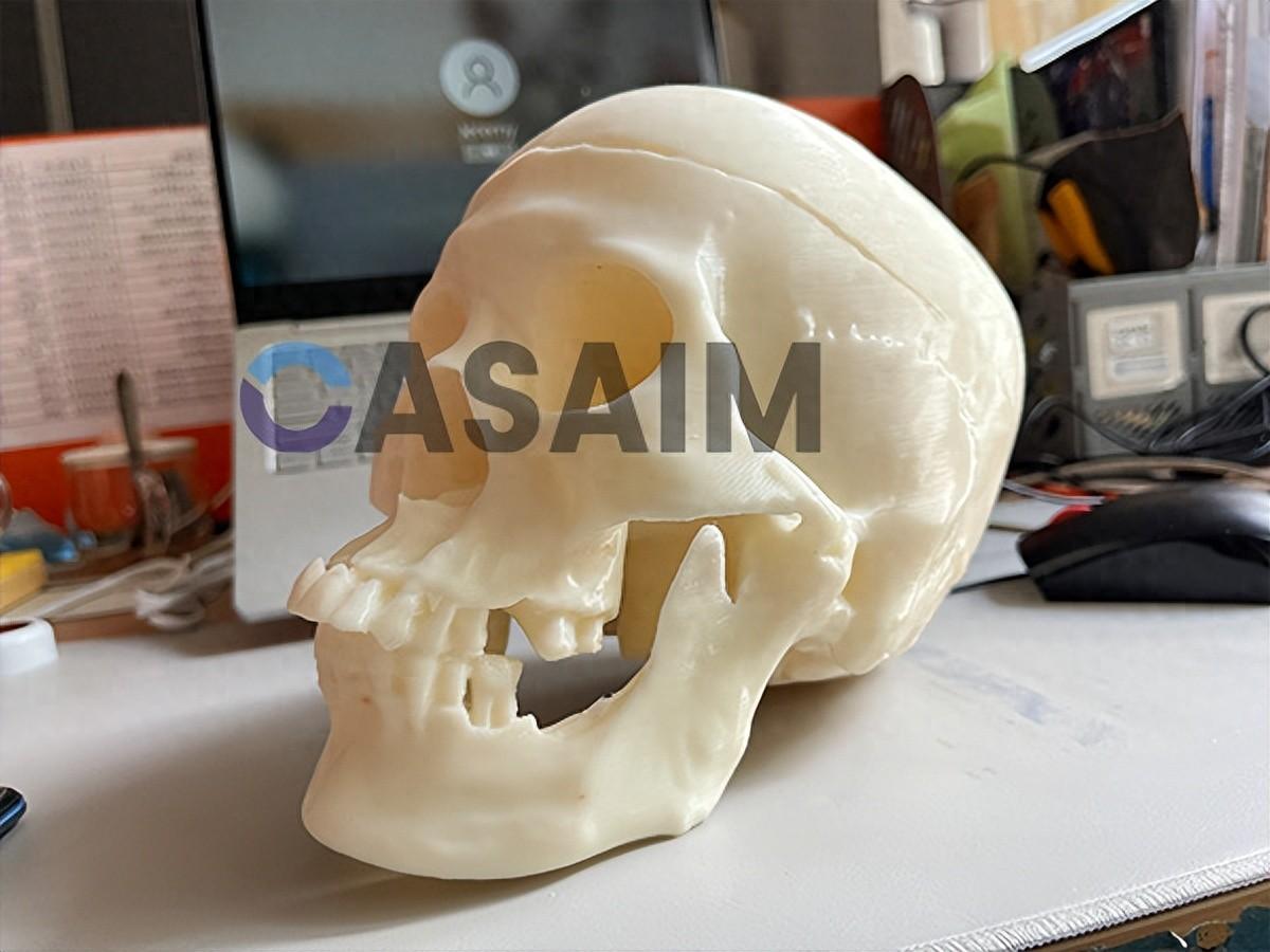 三維掃描與3D打印在法醫頭骨重建中的突破性應用