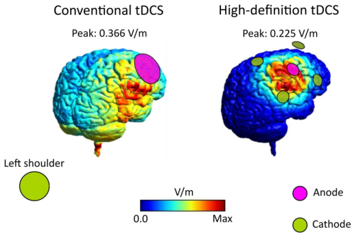 24d6da94-eb95-11ef-9434-92fbcf53809c.png