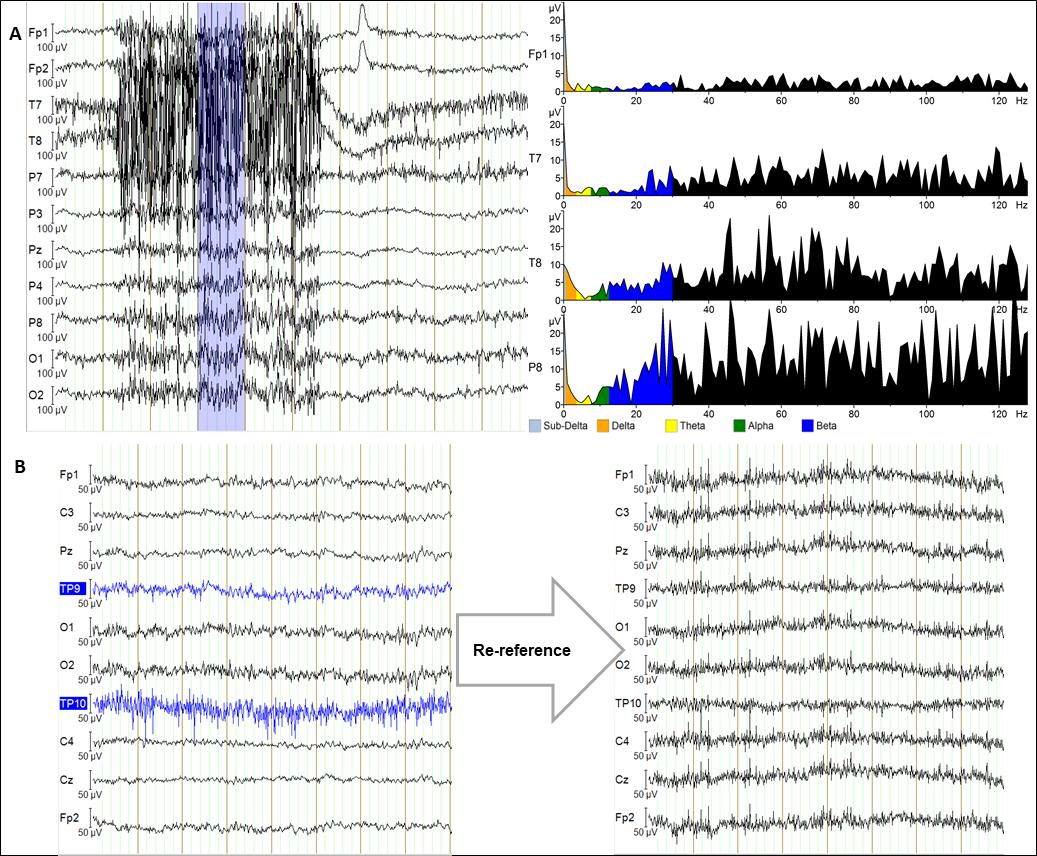 6eeec58c-f384-11ef-9434-92fbcf53809c.png