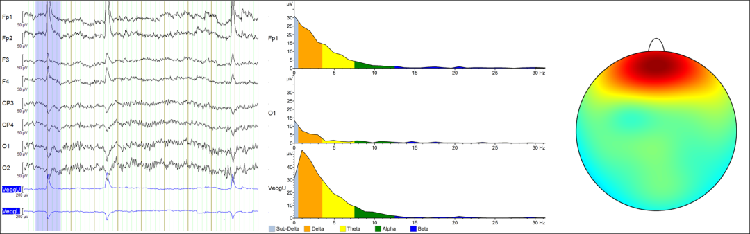6ebcfd86-f384-11ef-9434-92fbcf53809c.png