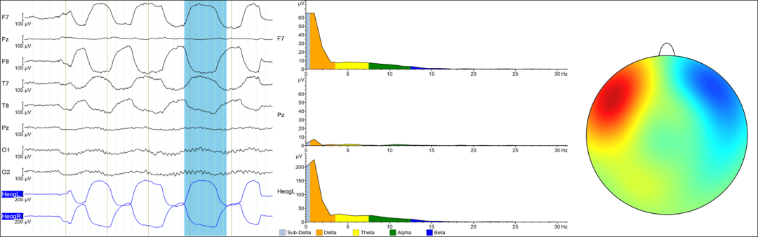 6ed819cc-f384-11ef-9434-92fbcf53809c.png