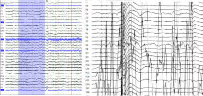 6f3e3a40-f384-11ef-9434-92fbcf53809c.png
