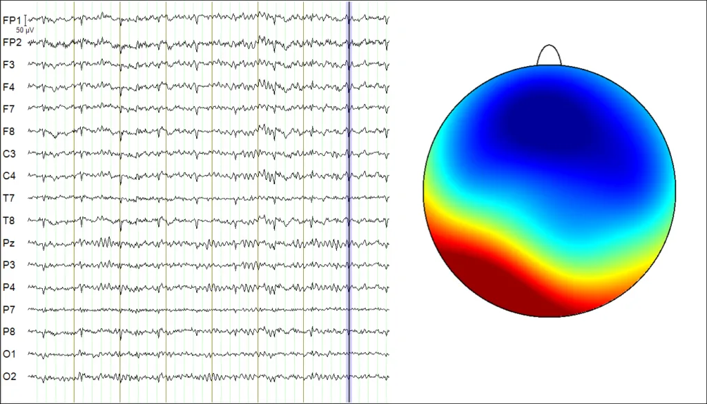 6ef44dfe-f384-11ef-9434-92fbcf53809c.png