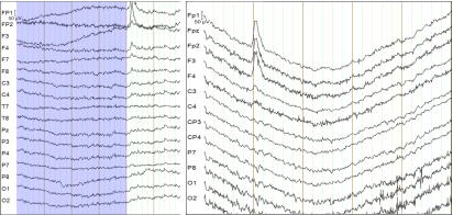 6f298faa-f384-11ef-9434-92fbcf53809c.png