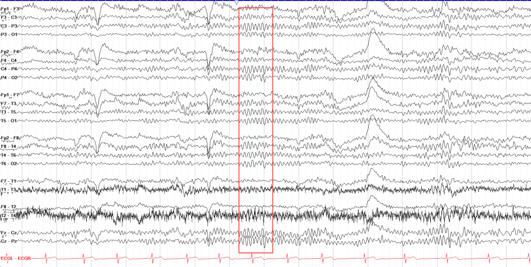 4efee918-016d-11f0-9434-92fbcf53809c.png
