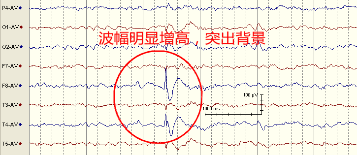 4eef1e5c-016d-11f0-9434-92fbcf53809c.png