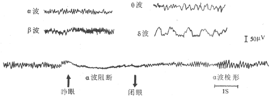 4ec5fab8-016d-11f0-9434-92fbcf53809c.png