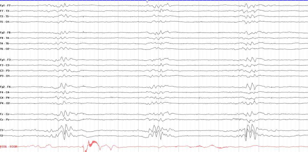 a9609fe0-0655-11f0-9434-92fbcf53809c.png