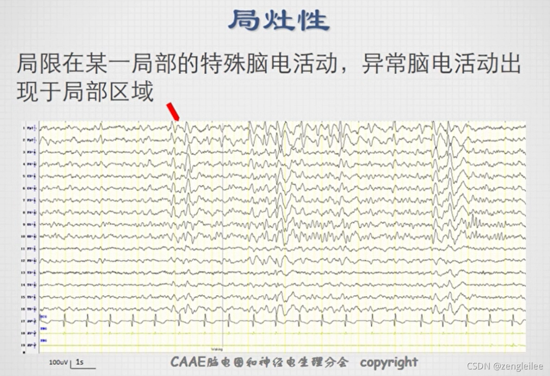 a9b2a09c-0655-11f0-9434-92fbcf53809c.png