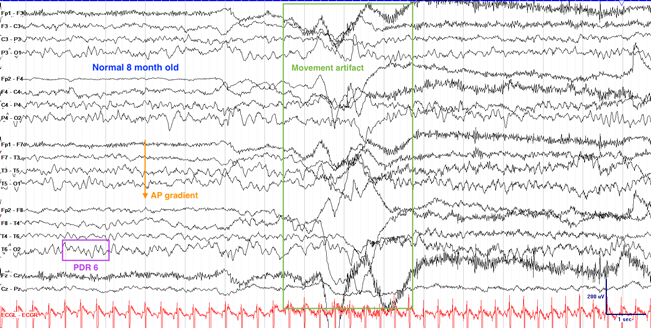 f658bfaa-0be9-11f0-9434-92fbcf53809c.png
