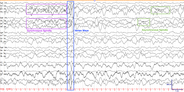 f6bd8908-0be9-11f0-9434-92fbcf53809c.png