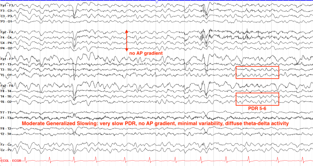 ef63f75a-0be9-11f0-9434-92fbcf53809c.png