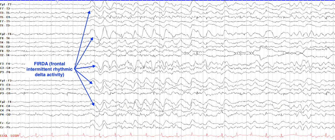 efbfeb00-0be9-11f0-9434-92fbcf53809c.png