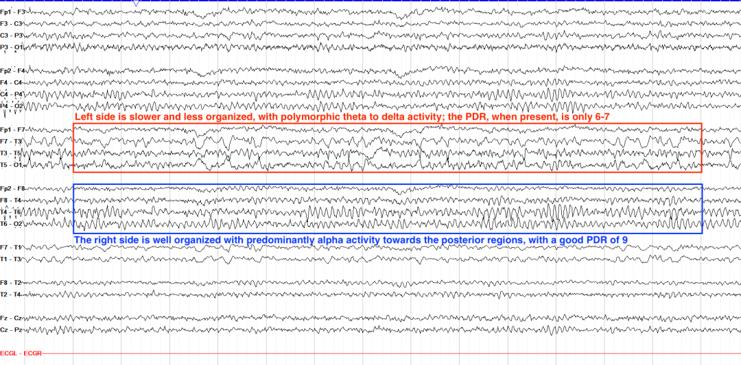 ef964fac-0be9-11f0-9434-92fbcf53809c.png