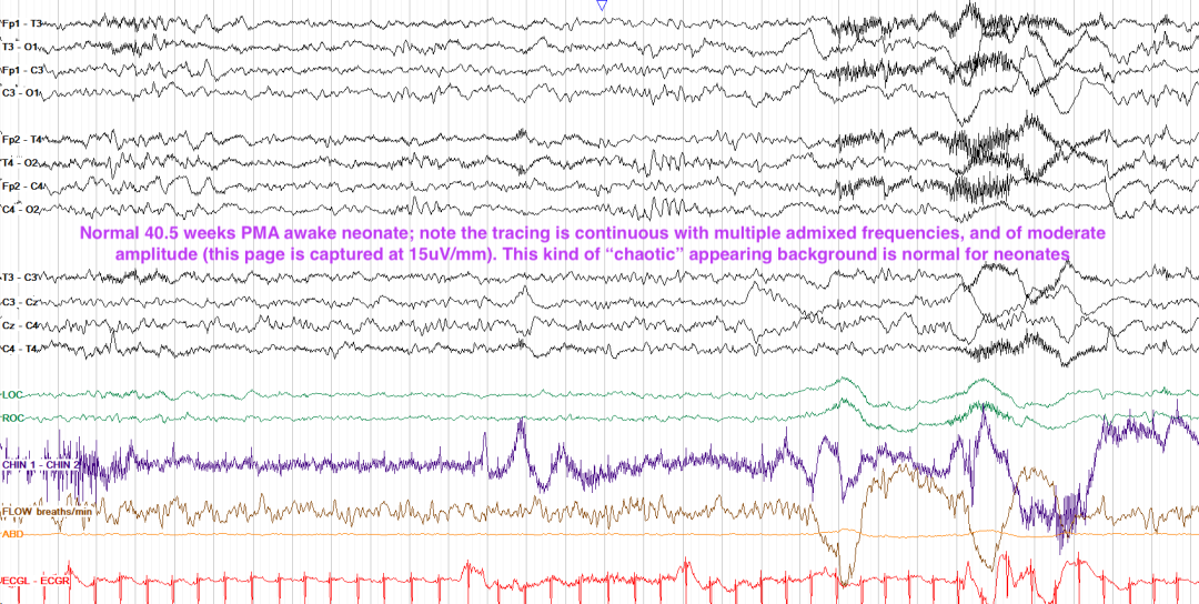 e458fe88-0edb-11f0-9434-92fbcf53809c.png