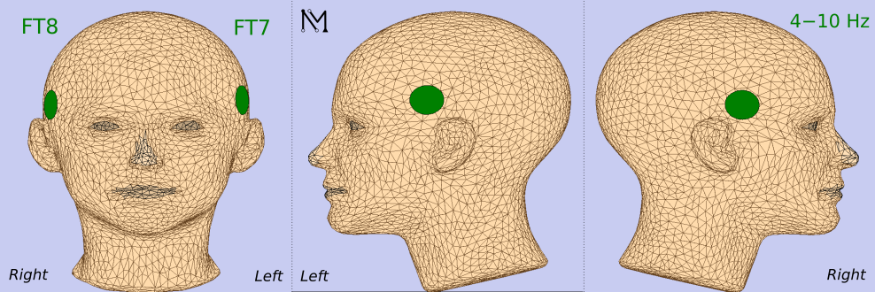 44e8ac00-1862-11f0-9434-92fbcf53809c.png
