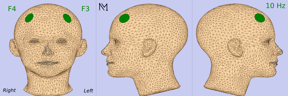 ab36e762-1a0e-11f0-9434-92fbcf53809c.png