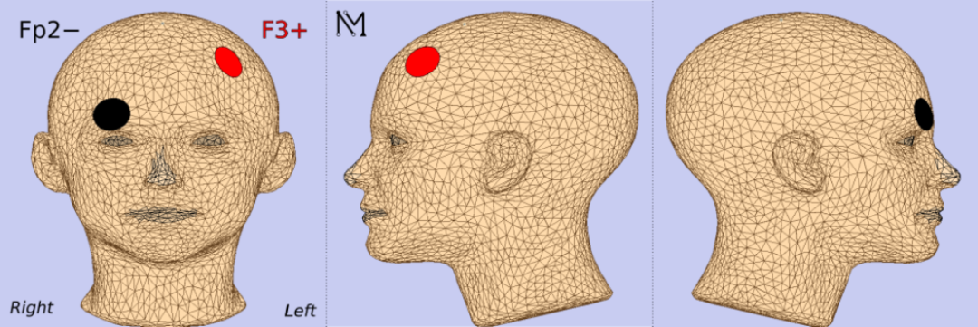 aafb5378-1a0e-11f0-9434-92fbcf53809c.png