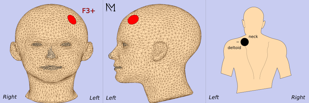 e6b2b9ce-1f68-11f0-9434-92fbcf53809c.png