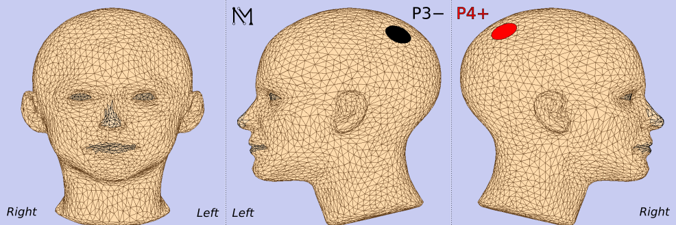 4949981c-25ab-11f0-9434-92fbcf53809c.png