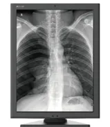 lcd