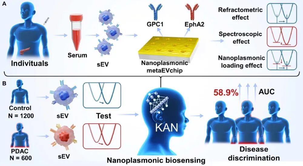 中國(guó)人民解放軍總醫(yī)院第五醫(yī)學(xué)中心：研究開(kāi)發(fā)的metaEVchip生物傳感策略可用于血清中超靈敏的sEV分析