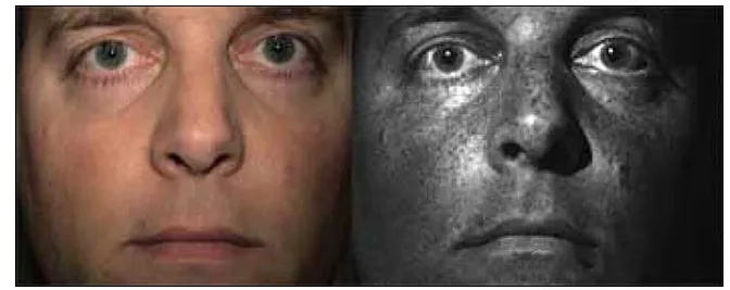 <b class='flag-5'>紫外</b>反射成像的应用