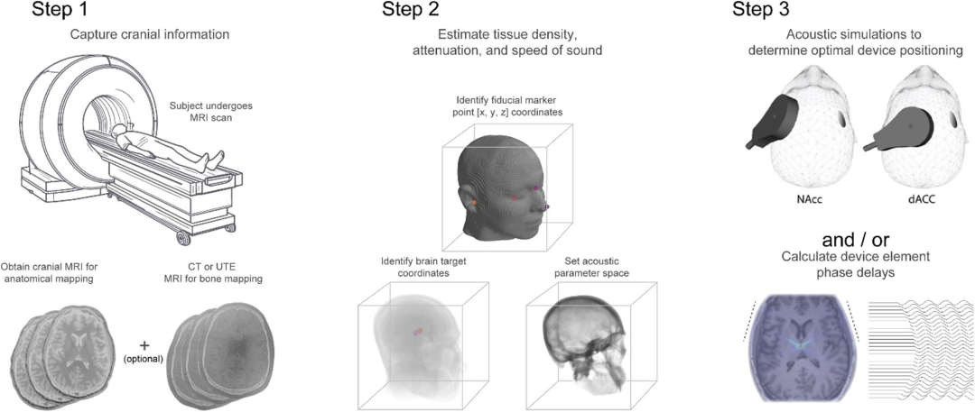 72c92856-0e3f-11f1-96ea-92fbcf53809c.png
