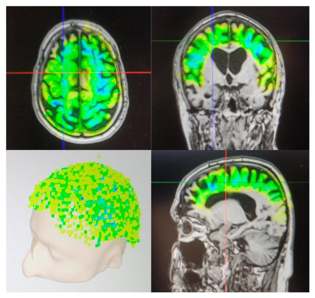 cdd6fe1c-148e-11f1-96ea-92fbcf53809c.png